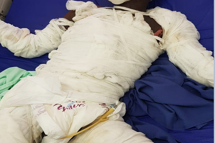 Luanda: Jovem morre queimado depois de tentar assaltar uma cabine eléctrica