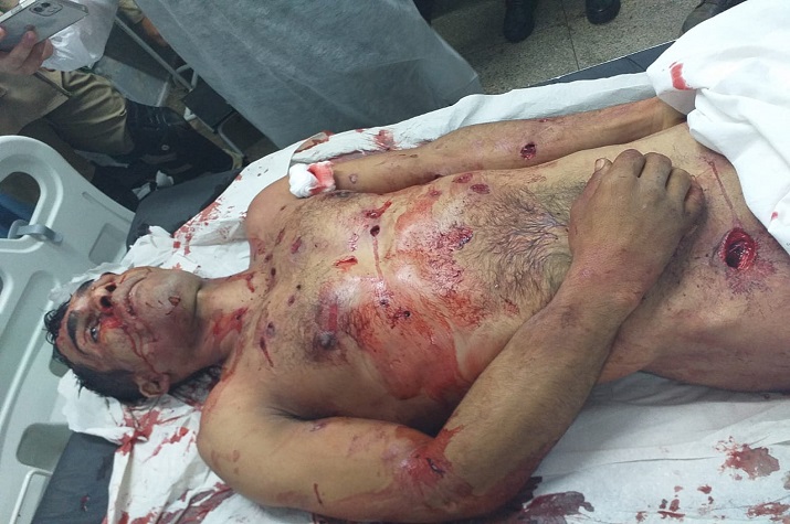 Criminoso mais procurado do Brasil teve corpo crivado de balas durante captura