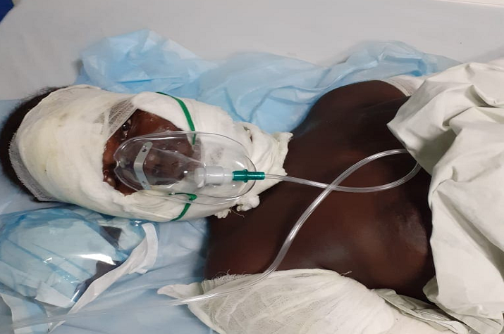 Moxico: Ancião ateou fogo na sua lavra e acabou por matar cinco membros da mesma família