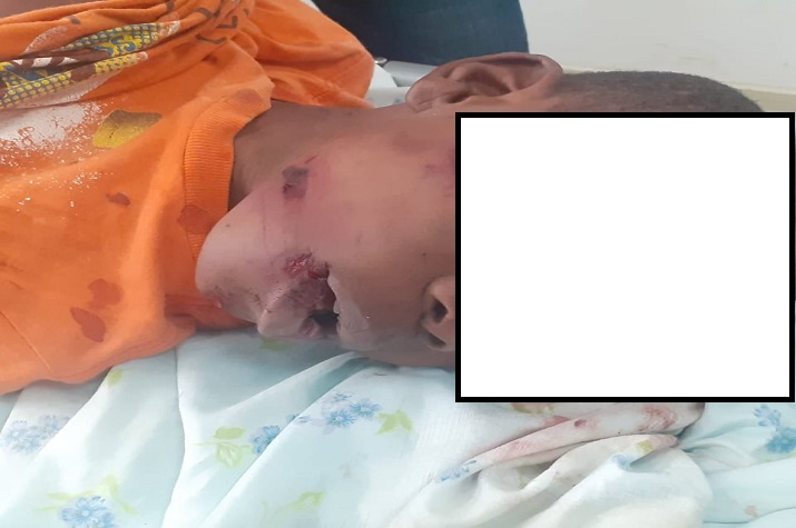 Oficial das FAA espanca o filho de 10 anos de idade até a morte