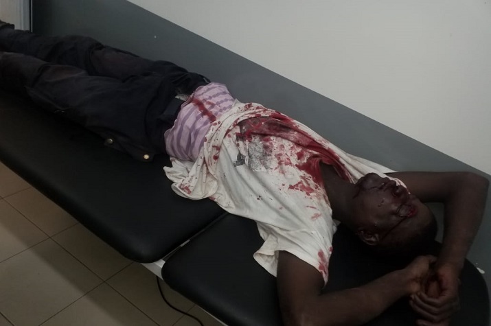 Lubango: Agente da Polícia espancado até a morte a 100 metros da sua unidade