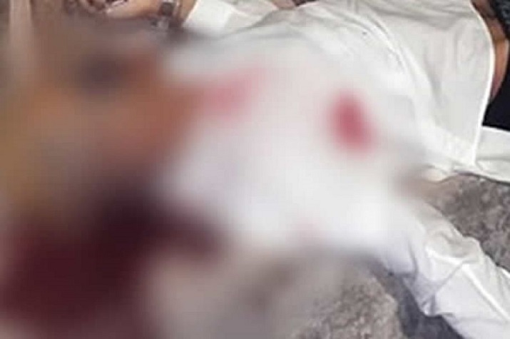 "Panina" rasga o peito da ‘amiga’ com metade de prato de vidro por ciúmes