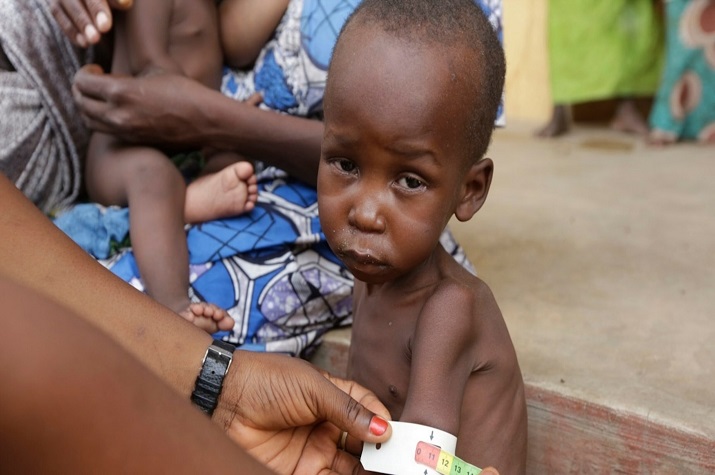 Fome: Mais de 32 mil crianças sofrem de desnutrição aguda grave no Cunene