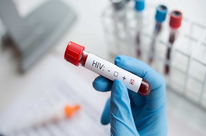 Cientistas testam com êxito vacina contra a sida