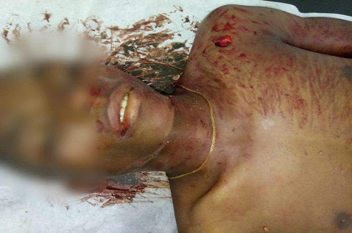 Adolescente de 17 anos assassinado com golpe de faca por interferir numa conversa