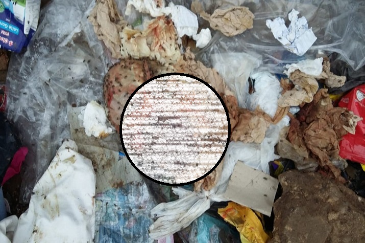 Feto encontrado numa lixeira do bairro Tunga Ngó