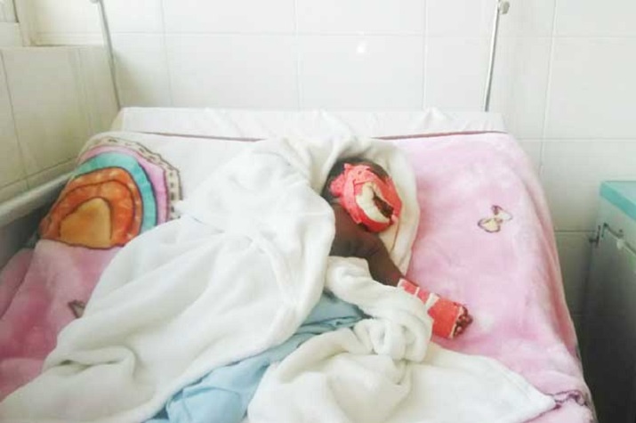 Adolescente de 17 anos tenta comer vivo o irmão de dois meses
