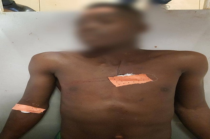Adolescente mata irmão com facada no peito depois de esbofetear a namorada