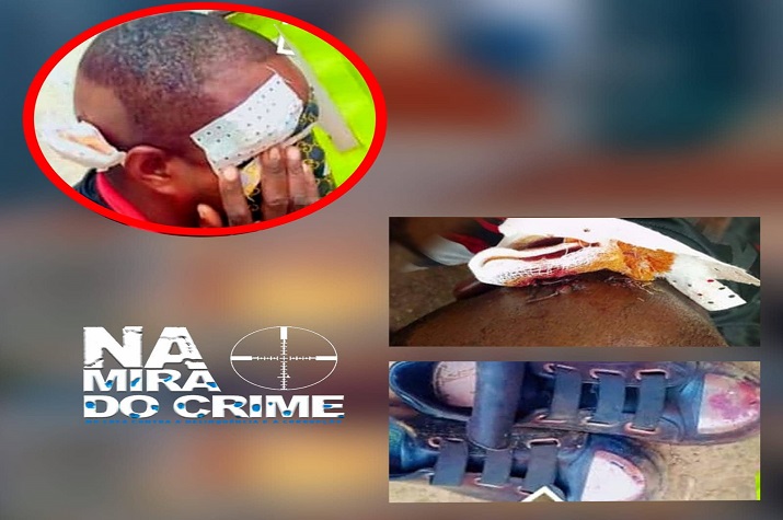 Agente da Polícia perde a pistola durante assalto e é brutalmente espancado no Cazenga