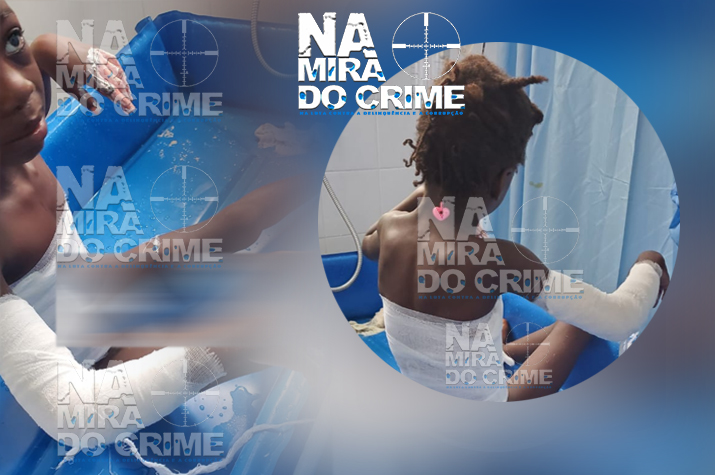 Cidadã joga papa quente no corpo da filha por esta ter comido a jinguba do negócio