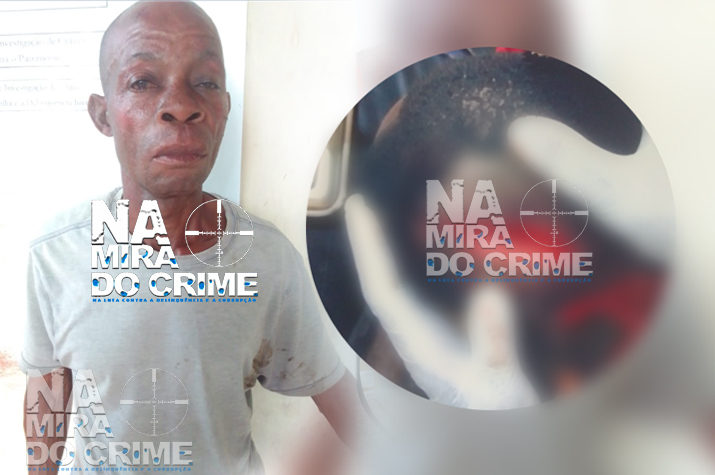 Atacado com uma Catana na cabeça- Cidadão quase perde a vida ao acudir o filho que estava a ser agredido