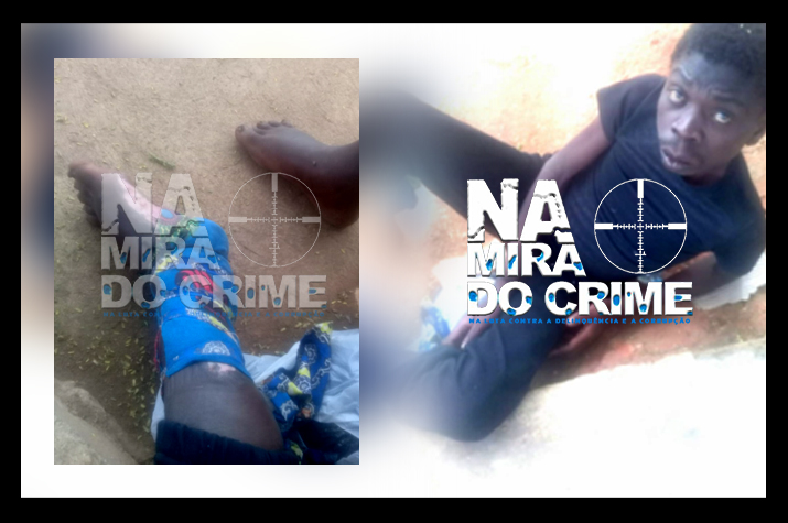 Cidadão com queimaduras na perna é abandonado na rua pelos familiares
