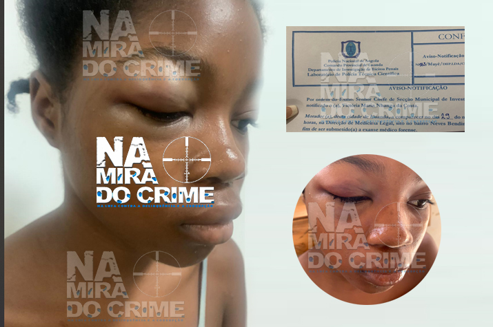 Em Cacuaco: Cidadã de 34 anos agride brutalmente menor de 15 anos por jogar papel na rua
