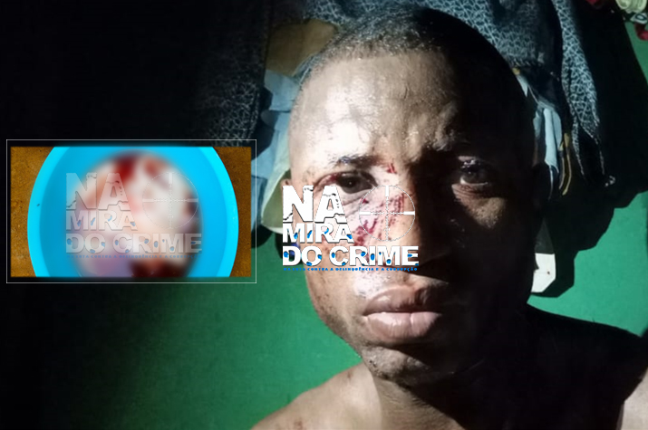 Jornalista da Rádio Despertar espancado brutalmente durante assalto a sua residência