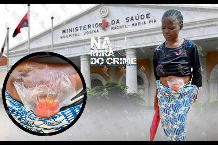 Mulher sofre há dois anos aguardando por cirurgia: Hospital Josina Machel alegava que a fase gratuita estava encerrada