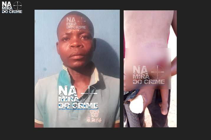 Brutalidade no Zango – Cidadão de 34 anos de idade espanca menor de 02 anos com pau