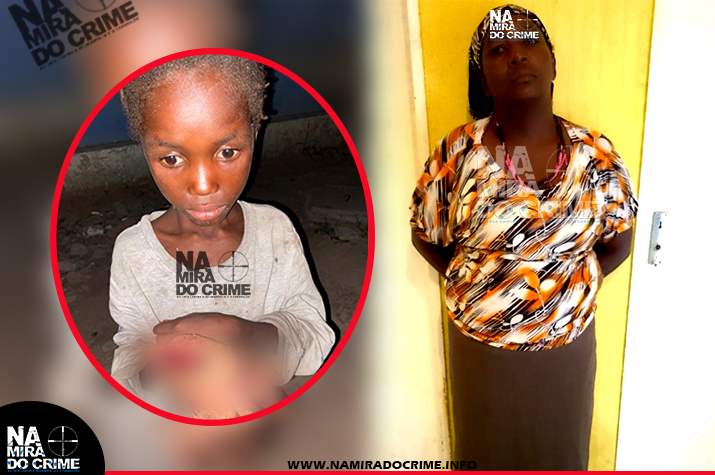 Por desvendar segredos ao pai – Mulher de 42 anos mergulha mão da filha de 06 anos de idade em água fervente