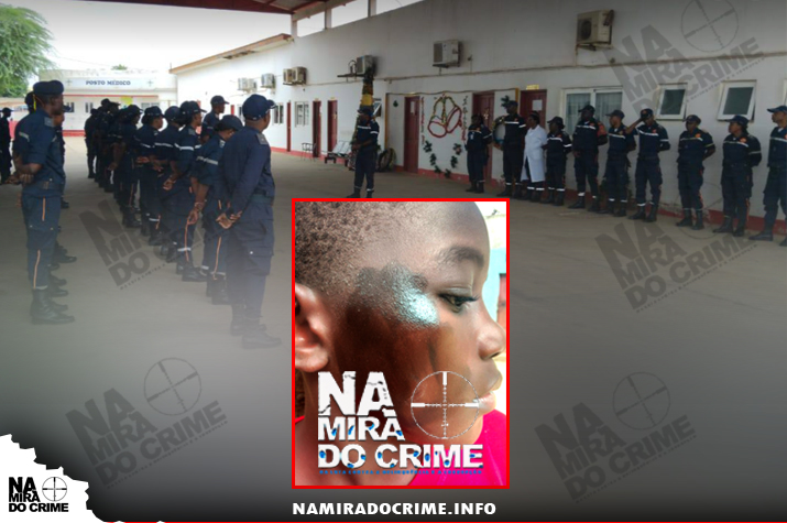 “Está a ser protegido pela chefia”: Efectivo de Bombeiros acusado de agredir menor de 11 anos com coronhadas no rosto por passar junto a porta de arma