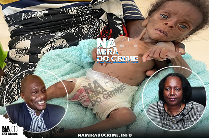 Na Huíla: Bebés estão a morrer por desnutrição aguda no Hospital Pediátrico Pioneiro Zeca