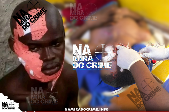Polícia no Cazenga acusada de soltar cidadã que agrediu gravemente jovem de 23 anos com blocos e caco de garrafa