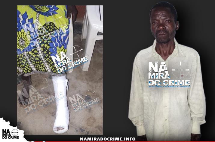 Marido parte a perna da mulher por faltar fuba para fazer funge