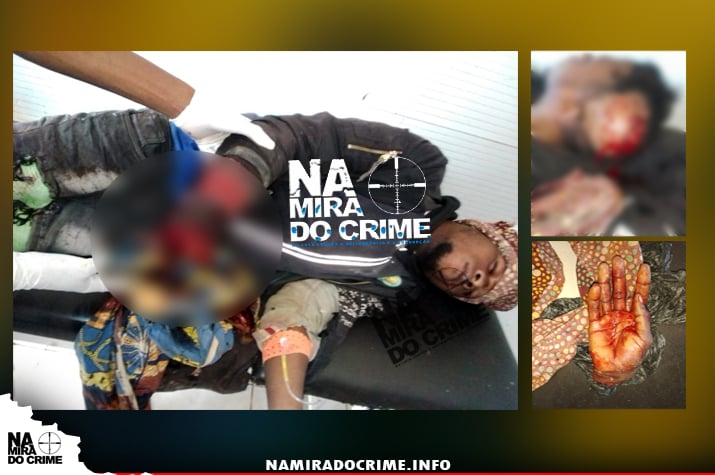No Bailundo: População corta a mão de ‘ladrão de galinha’ por reincidência no crime