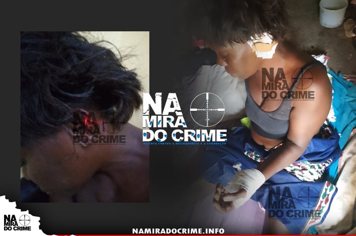 Sambizanga - Marginal corta orelha de cidadã de 52 anos de idade em assalto na via pública