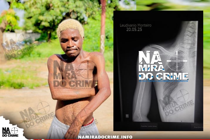 Depois de 06 mês em coma - Kudurista brutalmente espancado por marginais clama por ajuda para sobreviver