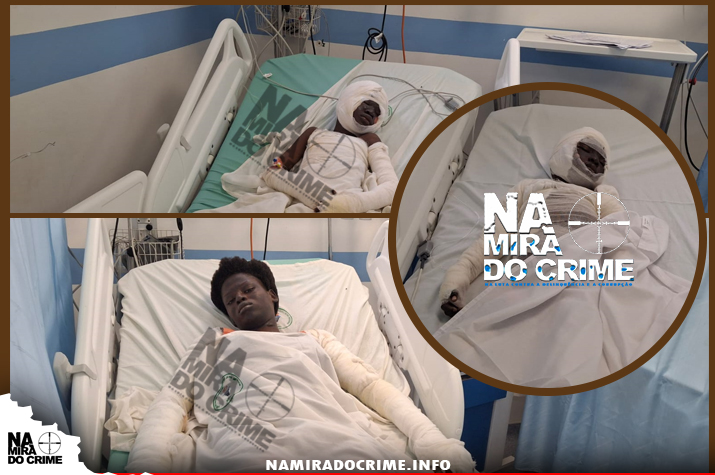 Algo deu errado na botija - 04 membros da mesma família queimados na Mabor quando preparavam comida à luz de vela