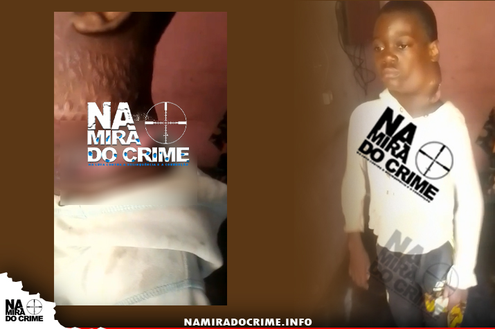 Em Cacuaco - Adolescente de 14 anos padece de tumor maligno e familiares clamam por ajuda do MINSA