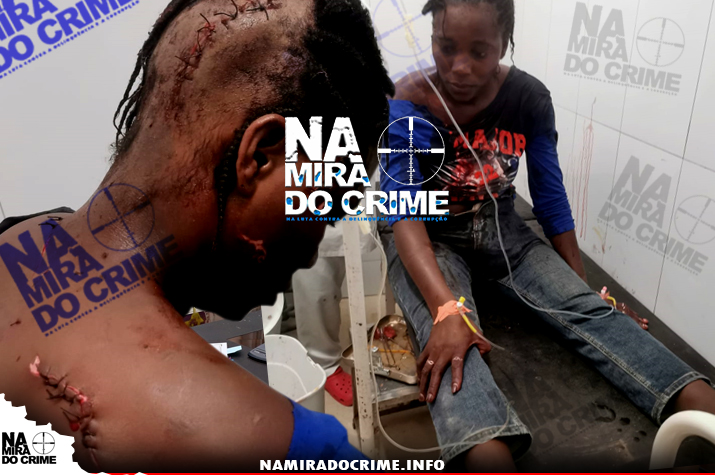 Benguela: Mulher de 30 anos atacada com catana por marginais durante assalto na via pública, foi suturada com mais de 25 pontos