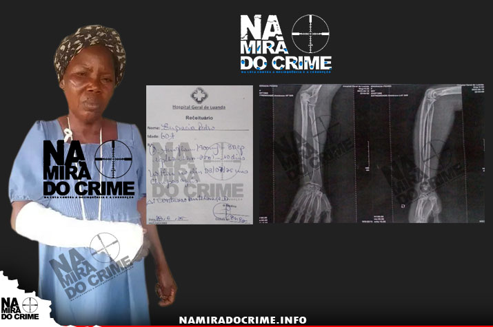 Chefiados pelo “Que Brilha” - Agentes da fiscalização acusados de agredir fisicamente no Camama