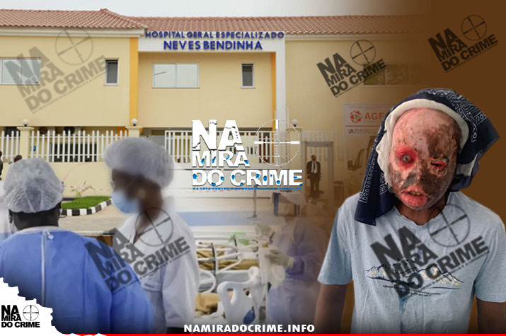 Queimou o rosto em água quente quando pretendia fazer "soador": Paciente internado no Hospital Neves Bendinha clama por ajuda da sociedade angolana e da Primeira-dama da República