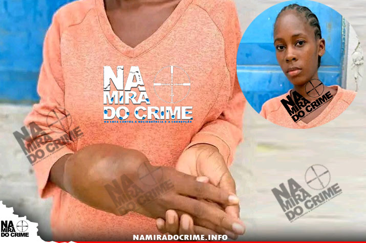 Médicos no Maria Pia "dizem que é uma doença grave e desconhecida": Jovem de 24 anos padece de um 'tumor maligno' no braço e clama por ajuda