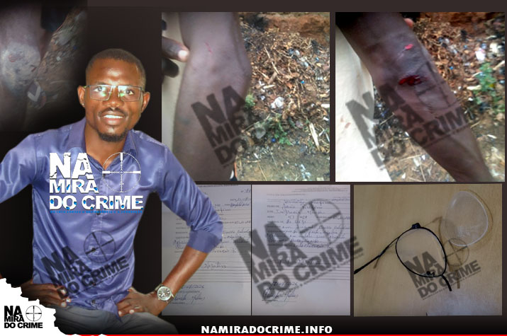 Espancado na manifestação – Polícia no Kilamba Kiaxi acusada de perseguir activista que denunciou troca de seringa no Hospital Geral de Luanda
