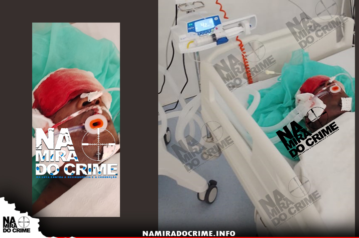Está em coma: Cidadão internado na UTI após ter sido brutalmente espancado pelos bandidos do grupo "Malta 720" do Belo Monte