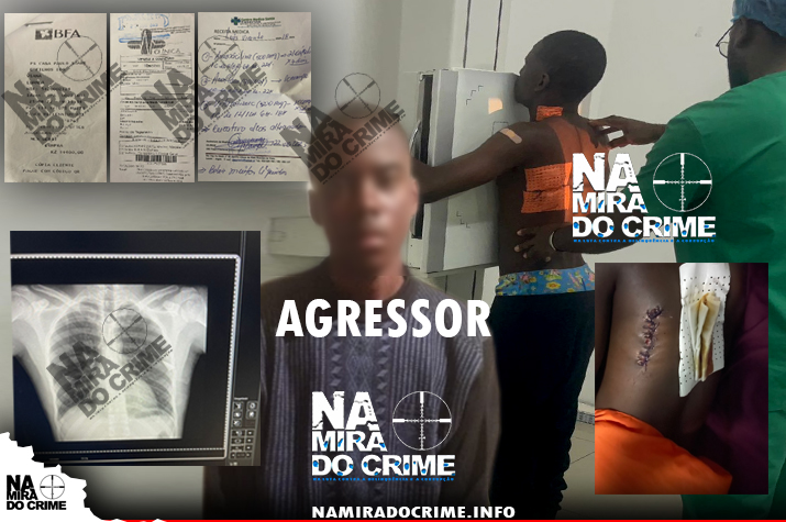 Agressores estão em liberdade - Jovem é agredido por 04 vizinhos da mesma família com faca e catana após desentendimento provocado por uma chamada de atenção, parte da faca ficou cravada nas costelas