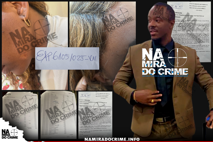 Com cicatrizes profundas no rosto – Cidadã nacional acusa ex-marido da Guiné Conacry de fuga à paternidade e de a violentar durante 05 anos de casado