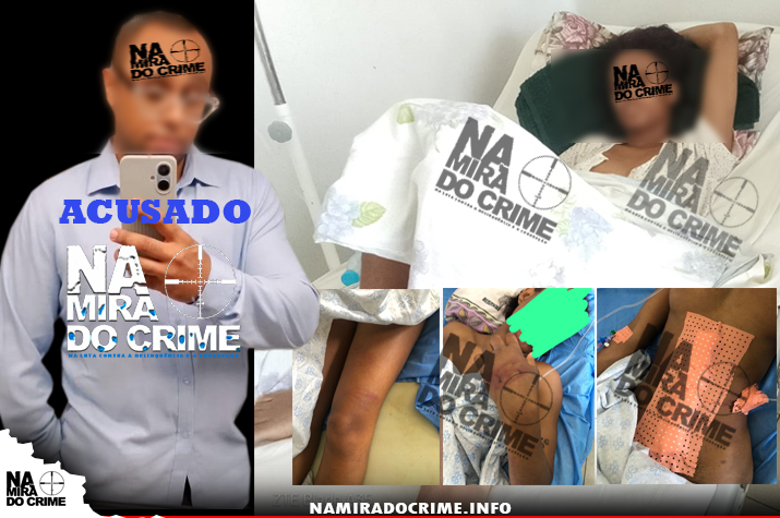 Não aceita separação: Suposto efectivo do SIC-Luanda acusado de agredir brutalmente a ex-namorada na Ilha do Mussulo, jovem teve dois ossos do braço fraturados