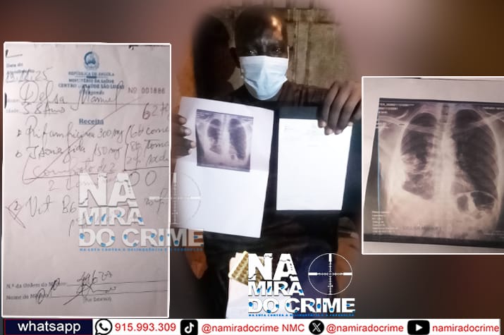 Centro de Saúde "São Lucas" nega-se a passar relatório médico a paciente em tratamento de tuberculose o que pode significar o seu despedimento do seu local de trabalho - Cidadão pede ajuda a ministra da Saúde