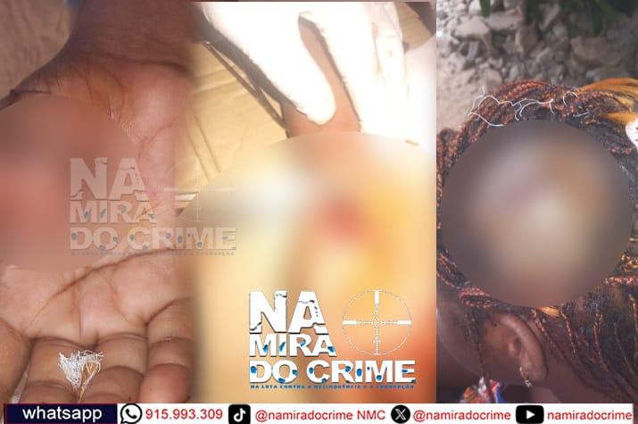 Tentativa de homicídio: Mulher de 20 anos atacada na sua residência com golpes de catana por marginais membros do grupo "Boy boy" no Baia