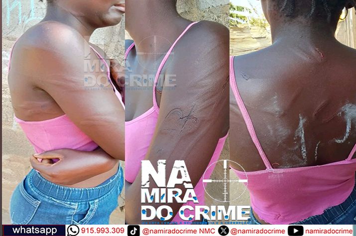 Cawango: Adolescente de 17 anos agredida com cabo de aço pelo  pai por ter aberto a porta à irmã que saía da maratona altas horas da noite