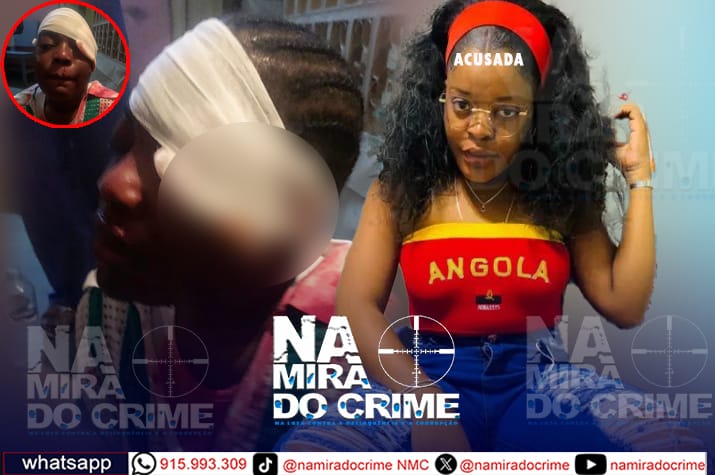 Quase furava o olho: Mulher parte garrafa e rasga o rosto de uma jovem porque teve um relacionamento amoroso o seu actual namorado