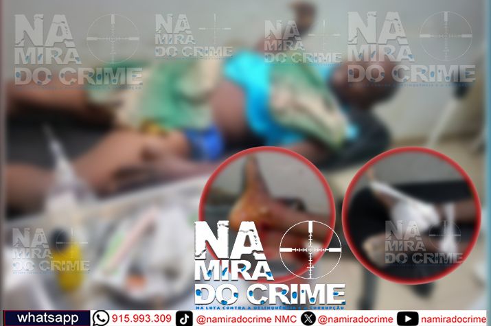 No Zaire: Bandidos assaltam residência de um cidadão de 40 anos de idade dispararam contra a coxa da vítima e cortam o calcanhar com catana