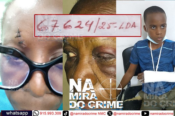 Família acusa efectivos do DIIP-Sambizanga de"engavetar" processo de agressão física depois de serem "brutalmente espancados" por um grupo de pessoas bem identificadas