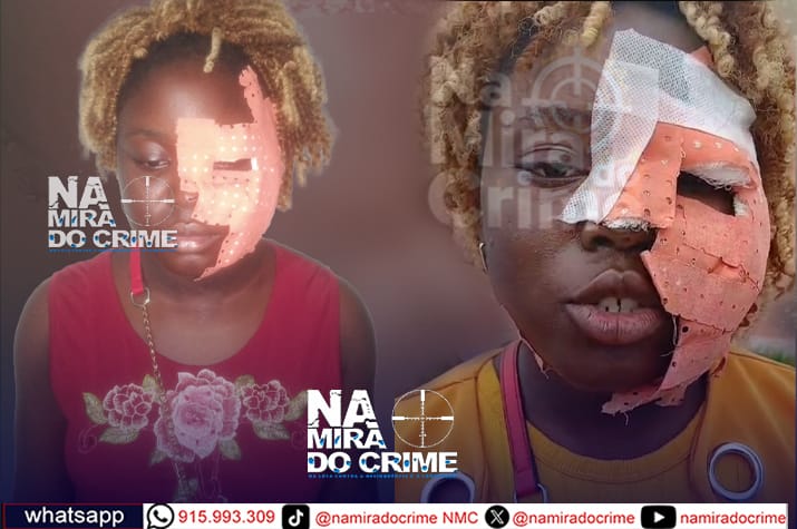 Levou mais de 40 pontos: Cidadã usa lâmina para esquartejar rosto da ex-rival - antes já havia mordido o braço do enteado - Está nas celas do Comando da Camama