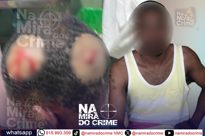Jovem de 26 anos agredido com golpes de faca na cabeça por um casal no Catambor