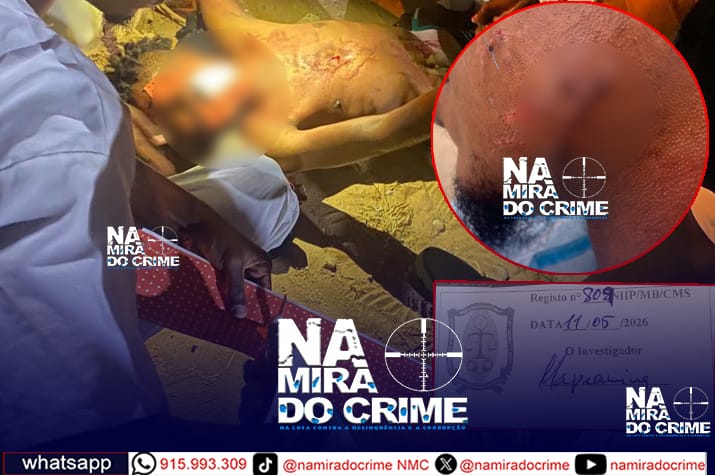 “Adilson” e comparsas desfiguram bochecha de jovem de 25 anos com caco de garrafa durante uma briga na Samba: Vítima foi suturada com 12 pontos e agressores podem ser soltos sob fiança