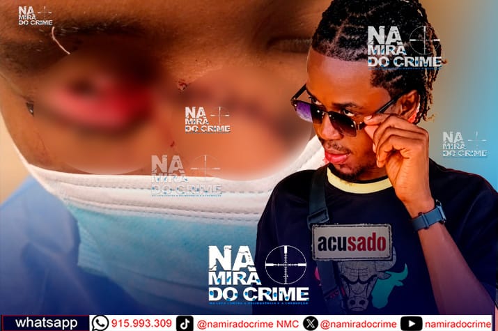 Atacado com caco de garrafa no rosto: Jovem perde um olho durante briga com o ex-marido da sua namorada