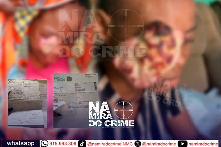 Paciente com tumor no olho direito aguarda tratamento oncológico há oito meses e pede intervenção urgente ‎ ‎